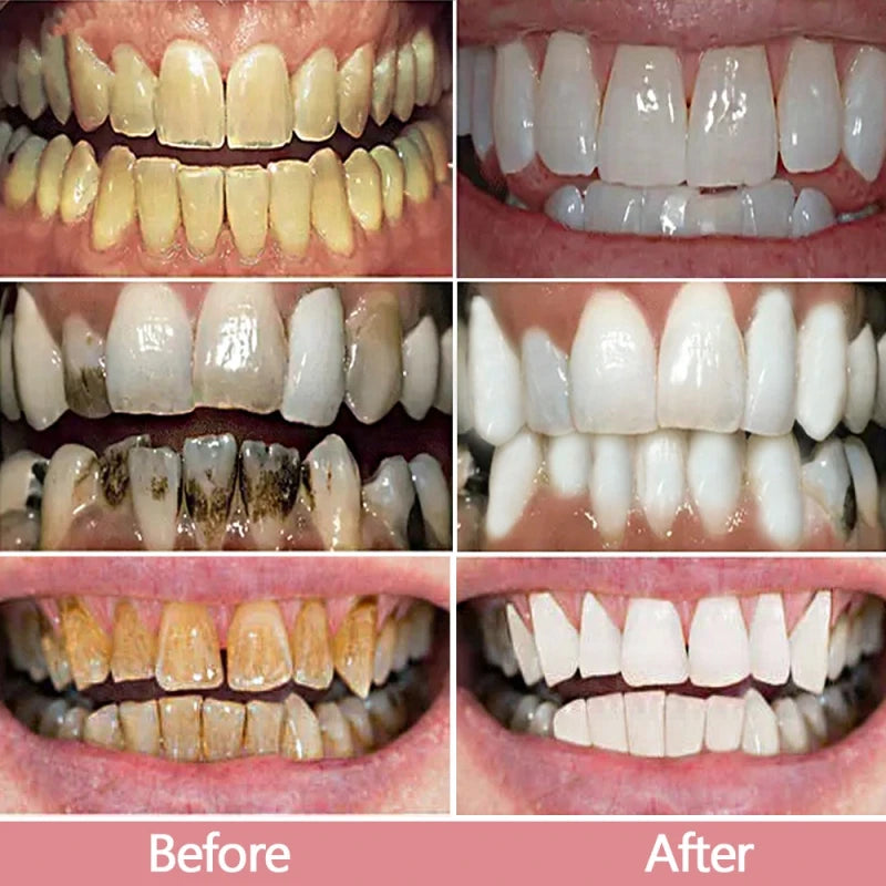 Dentifrice V34 Violet blanchisseur dentaire