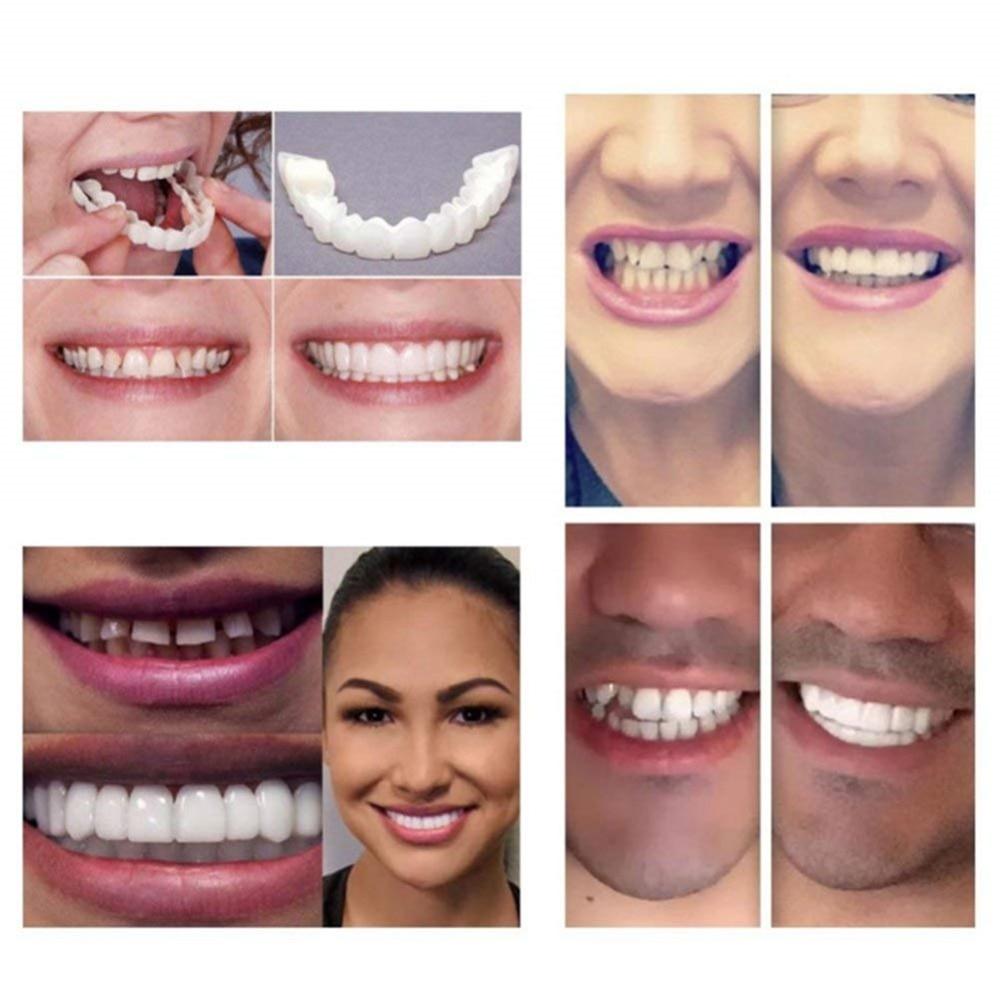 Dentier Esthétique Amovible
