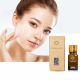Sérum Anti Taches Et Acné Corps Et Visage