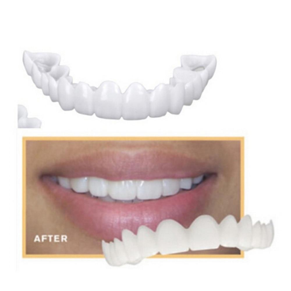 Dentier Esthétique Amovible
