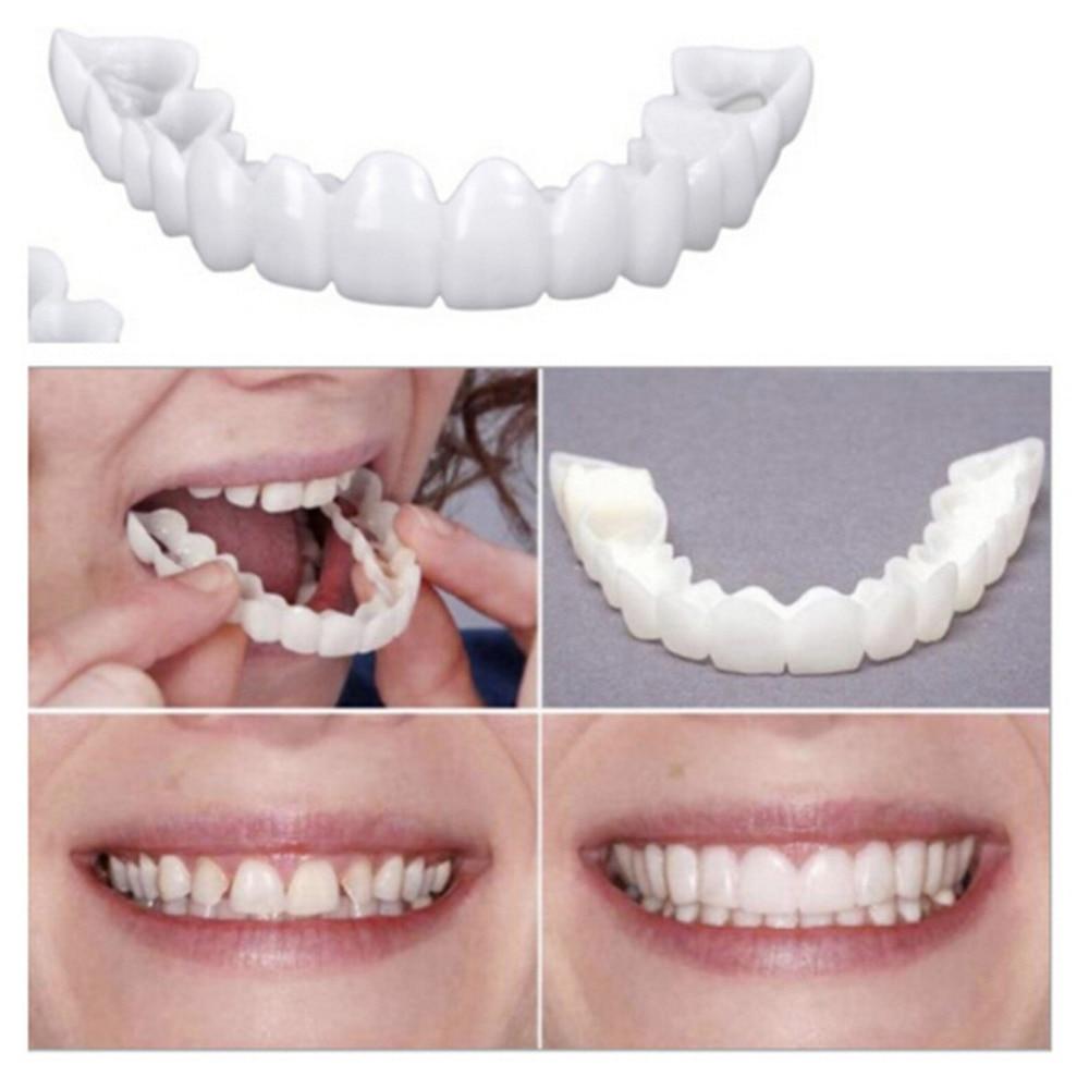 Dentier Esthétique Amovible