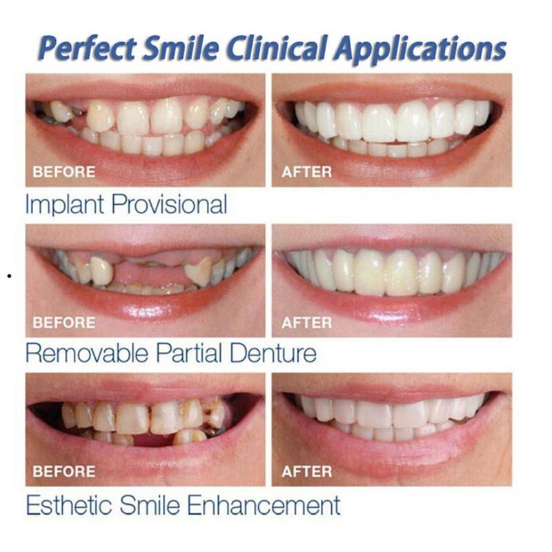Dentier Esthétique Amovible