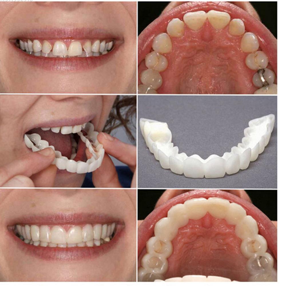 Dentier Esthétique Amovible