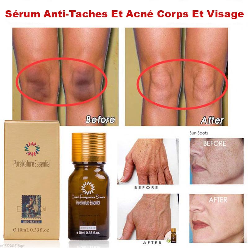 Sérum Anti Taches Et Acné Corps Et Visage